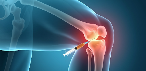 PPR therapy Lincoln NE Platelet Rich Plasma Injections