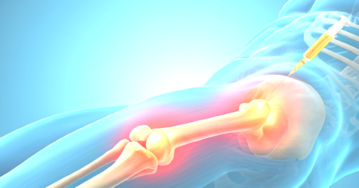 PAIN CLINIC DOCTOR SPECIALIST LINCOLN NE