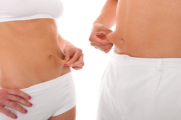 coolsculpting wetherford tx picture