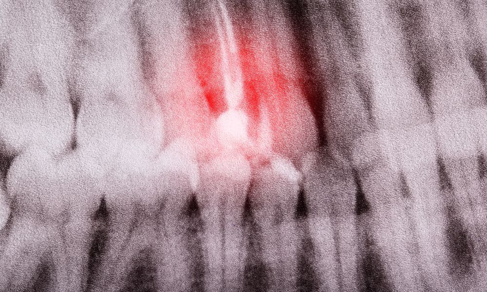 Root of Atypical Tooth Pain