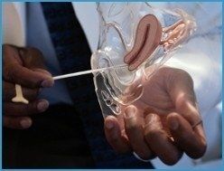 Prestazioni Prestazioni