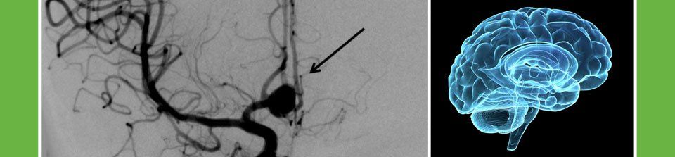 Dr. Eduardo Reyes - Neurocirugía