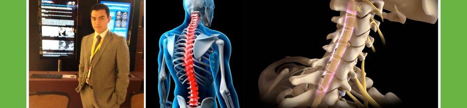 Dr. Eduardo Reyes - Neurocirugía endovascular