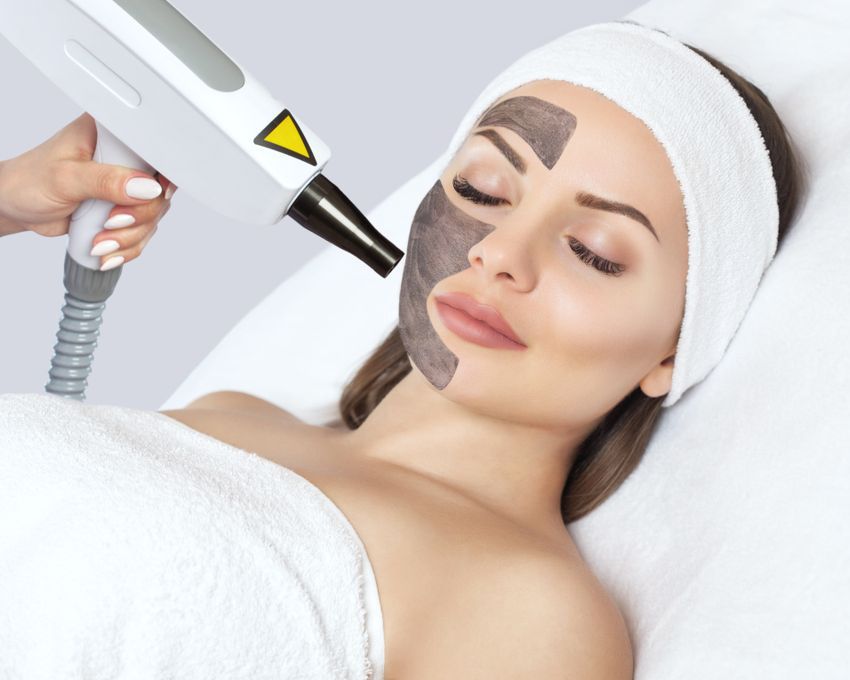 Carbon Face Peeling Treatment — Jina Robinson Skin-Cos-Medix In Albion Park NSW