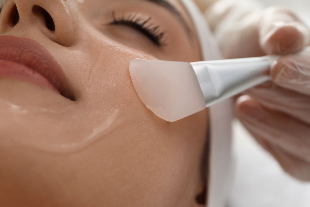 Close Up Of Woman Having Face Peeling Procedure — Jina Robinson Skin-Cos-Medix In Albion Park NSW