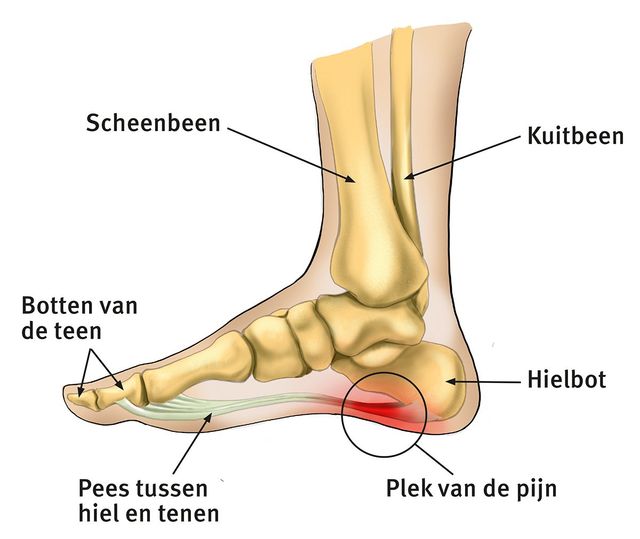 Podologie Podoloog Steunzool Podo castricum podotherapie podozorg