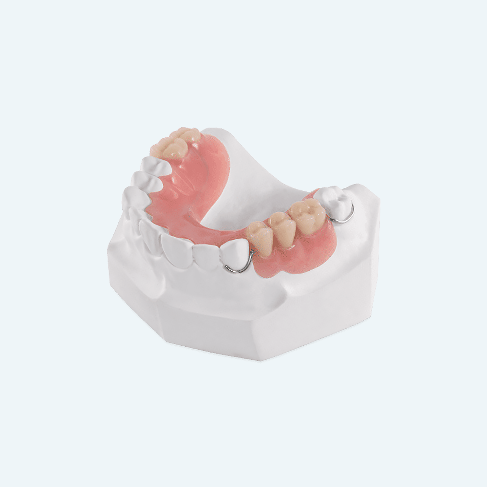 Partial denture on a white model, showing pink gum-colored base and tooth replacements.
