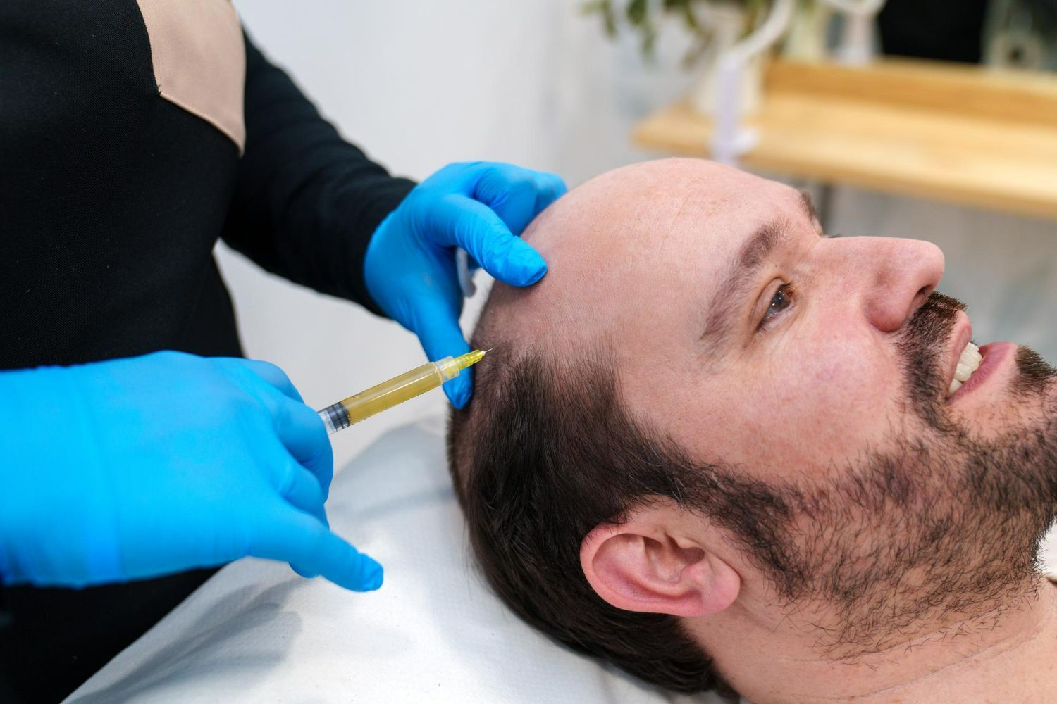 A person receiving a scalp injection for hair loss, administered by someone wearing blue gloves.