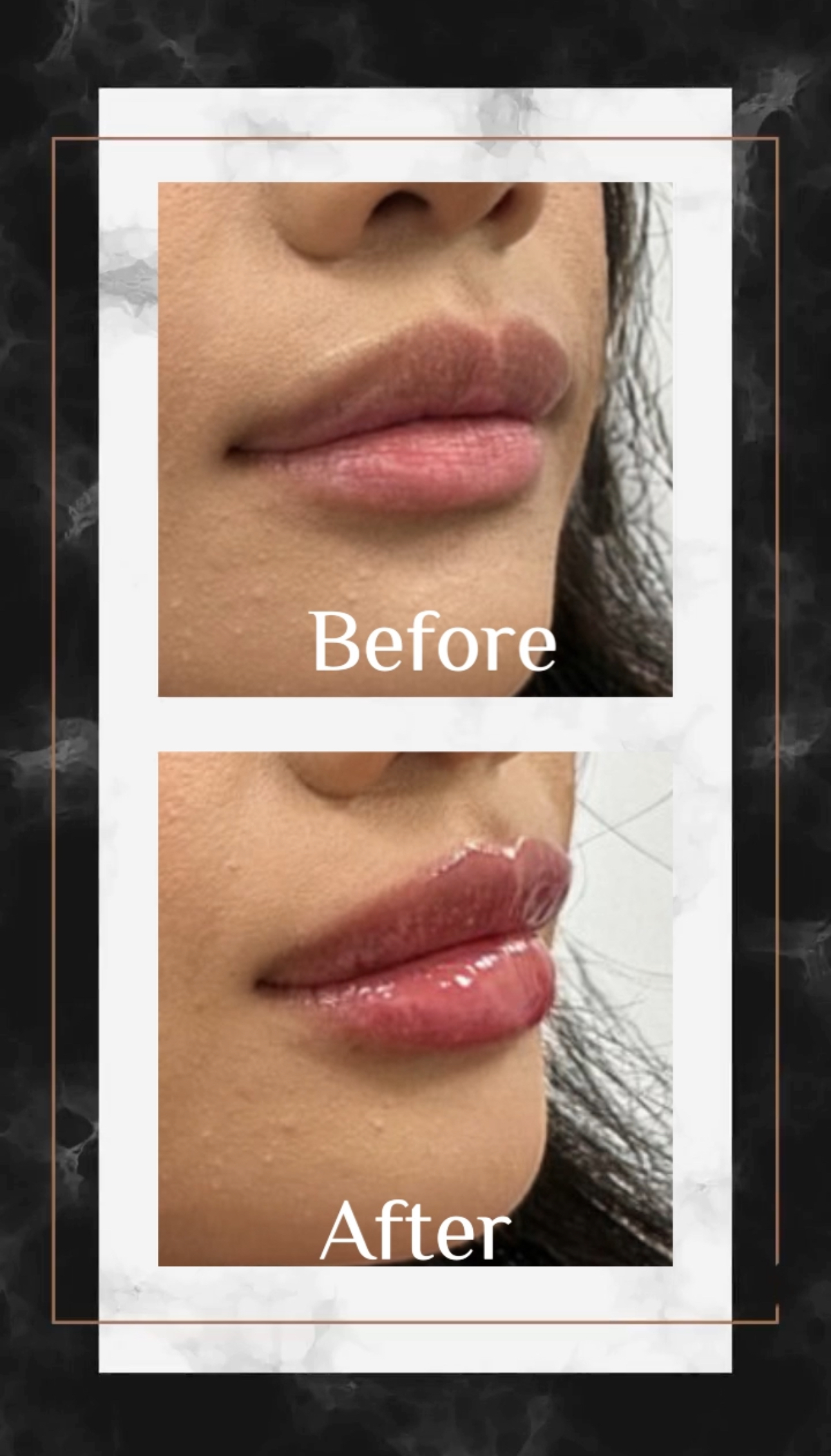 A before and after photo of a woman 's lips.