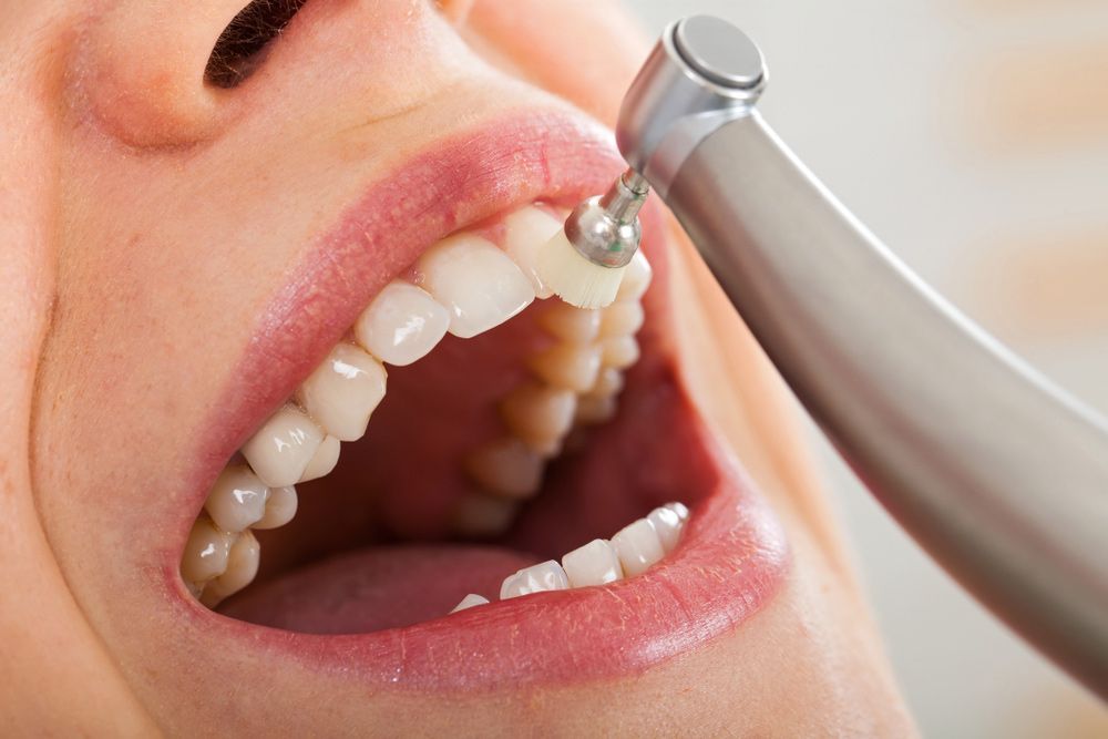 A woman getting her teeth professionally cleaned.