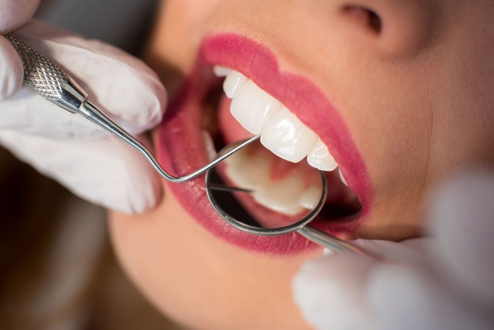 Dentist Performing Dental Checkup