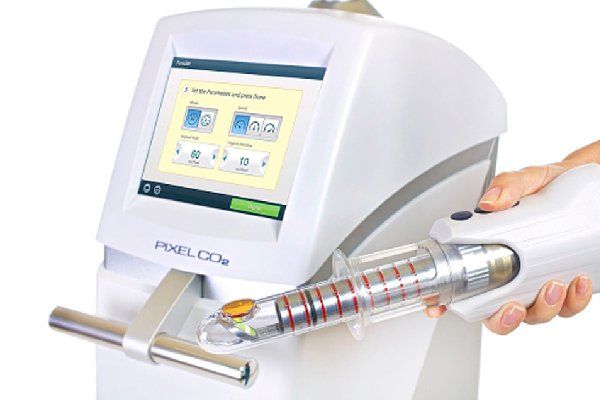 FemiLift™ device