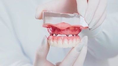 Carga Imediata: como é esse tipo de implante dentário?