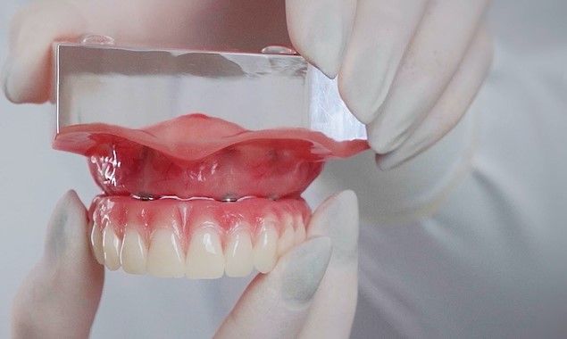 Prótese dentária fixa: o que é, quais os tipos, quanto custa