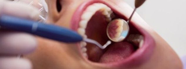 Abcesso dentário: causas, tratamentos e prevenção