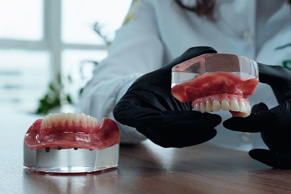 Implantes Dentários