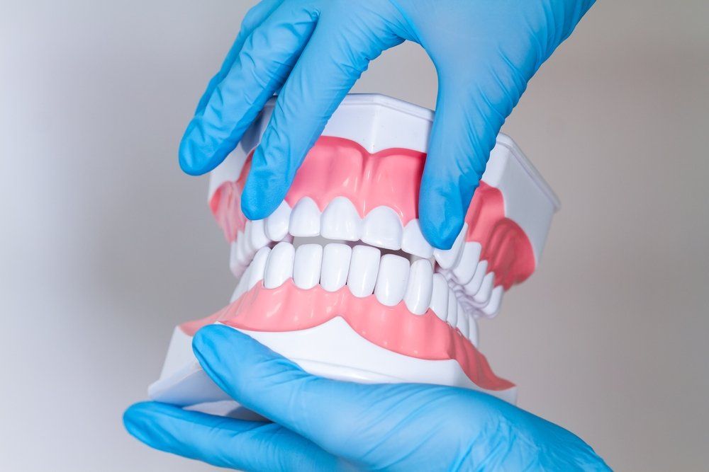 O que é implante dentário?
