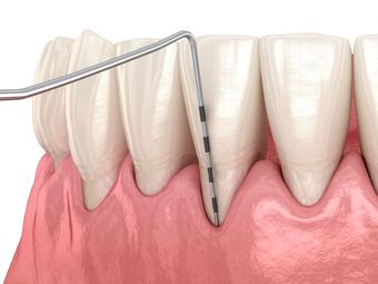 periodontics