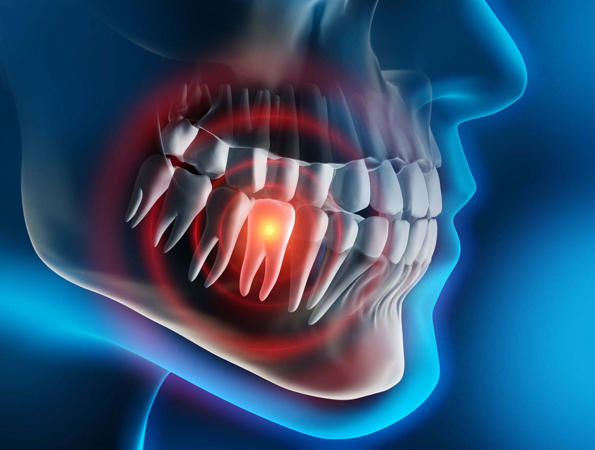 Tooth pain illustration