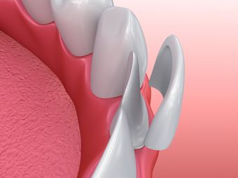 cosmetic dentistry