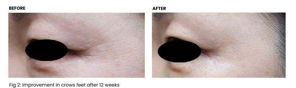 Comparison of a person's eye area 