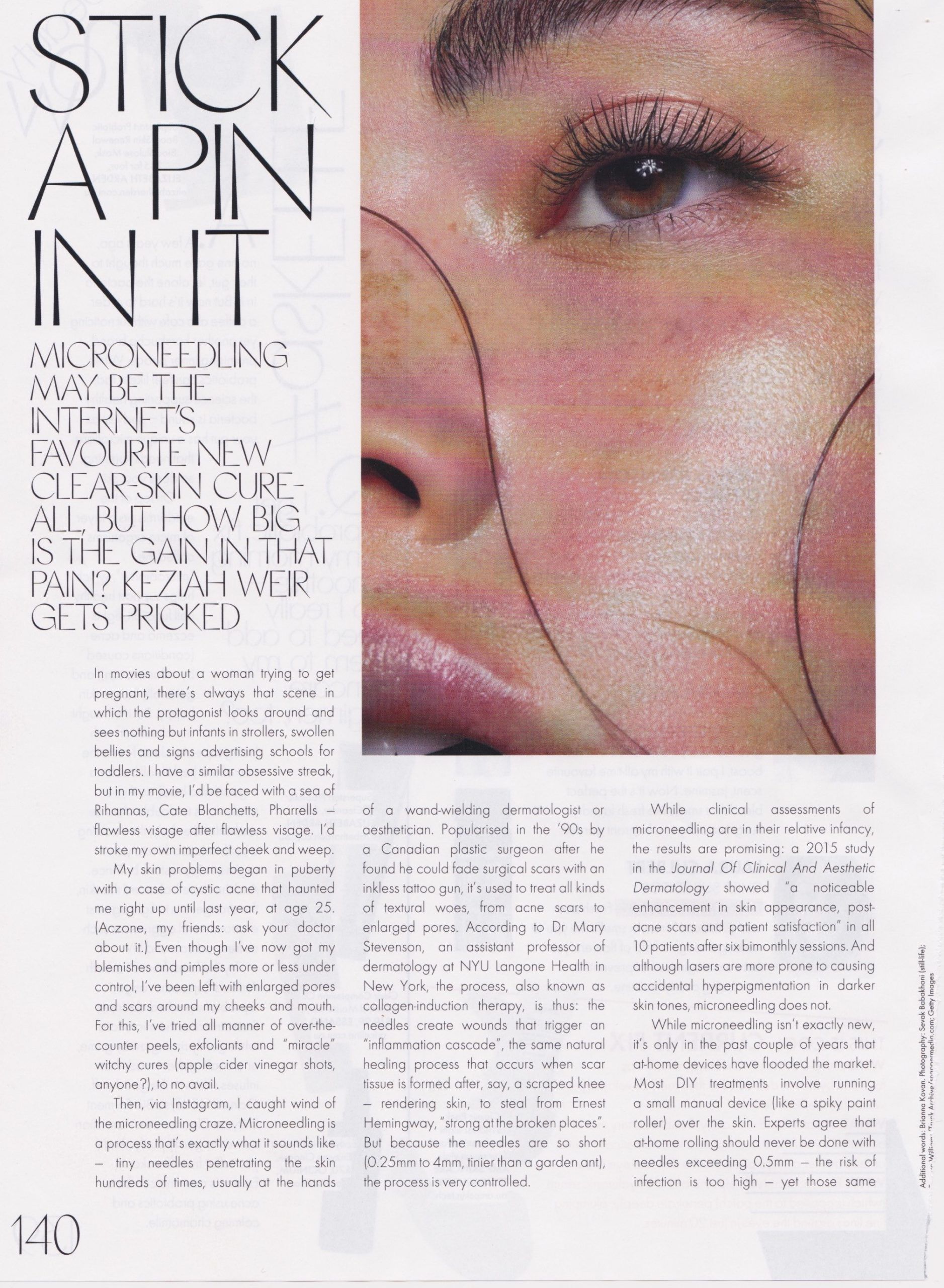 Close-up of a person's face with text overlayed, highlighting lines on the skin.