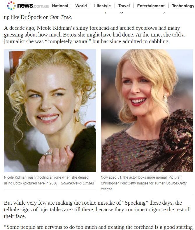 Side-by-side comparison of Nicole Kidman's face, one showing Botox use, the other, a more natural appearance.