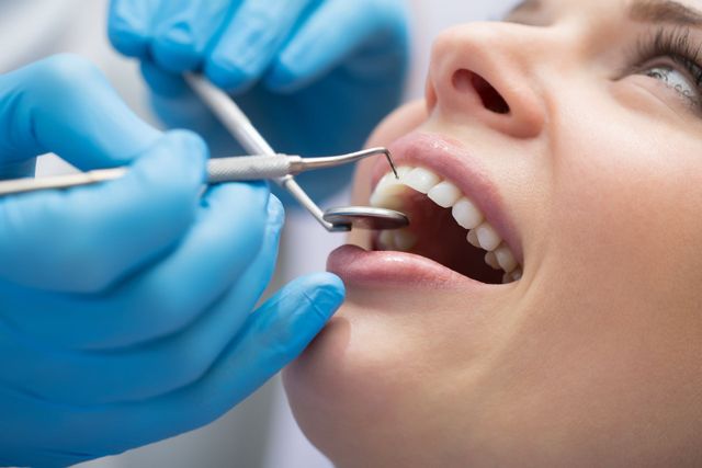 estetica dentale, igiene orale, detartrasi