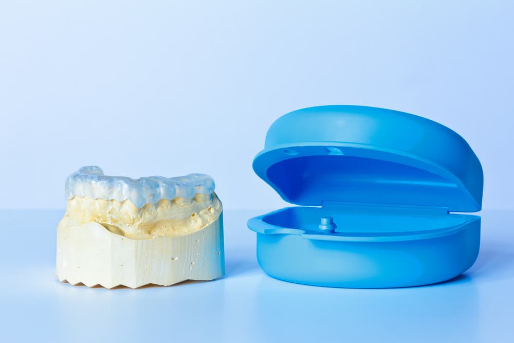 Custom-made Tooth Model With Blue Case - Custom Mouthguards In Albury, NSW