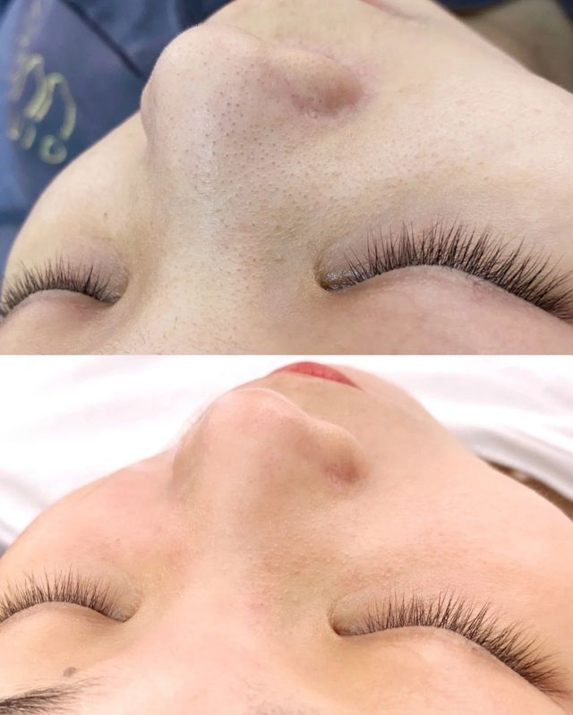 SKN Deep Cosmetic Clinic, Lash Lift & Tint