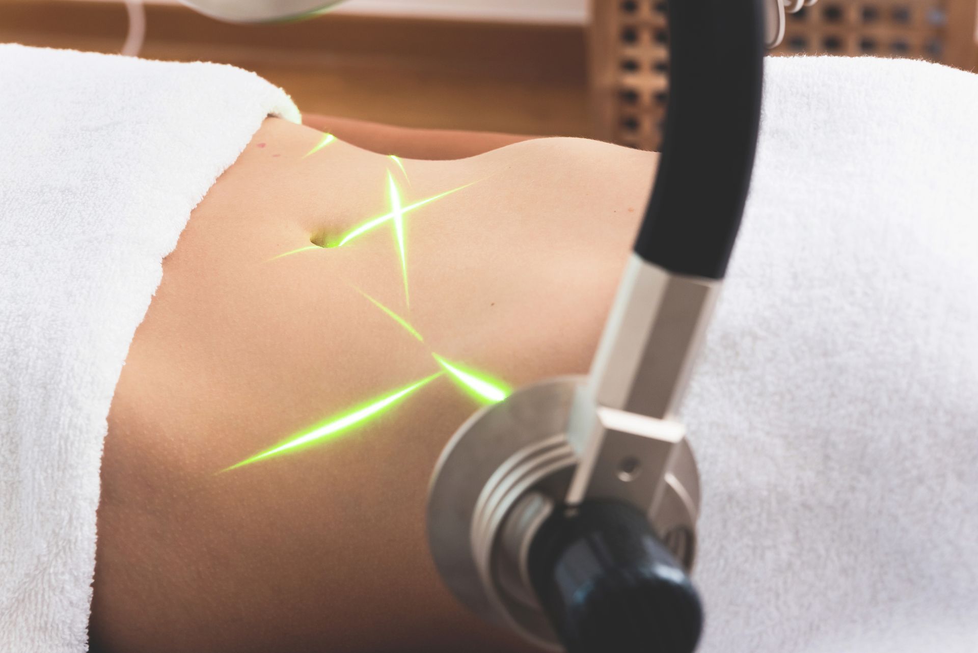 A woman is getting a laser treatment on her stomach.