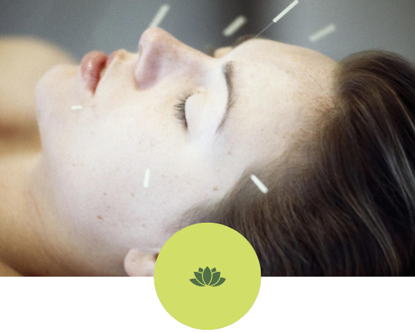 A woman is getting acupuncture on her face