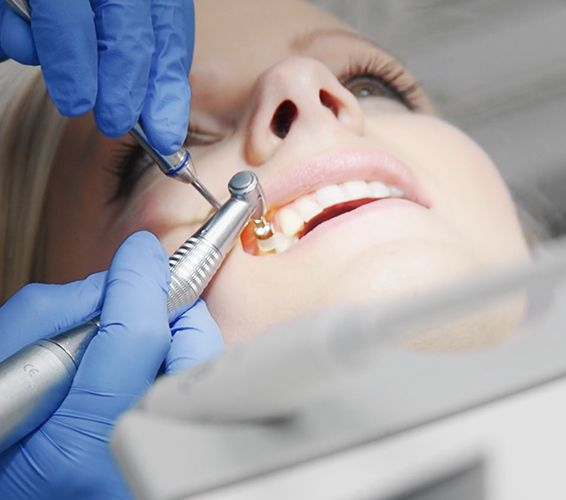 Tandarts die met een boor aan de tand van een patiënt werkt. Blauwe handschoenen, open mond, close-up.