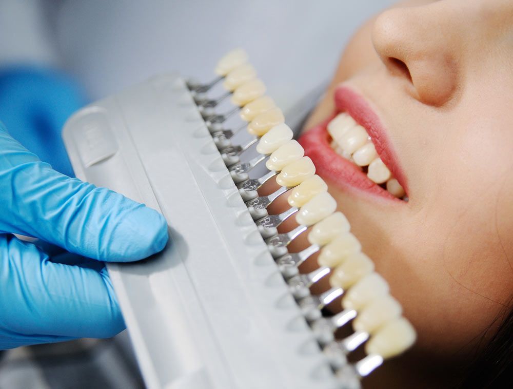 Cosmetic Dentistry Currambine