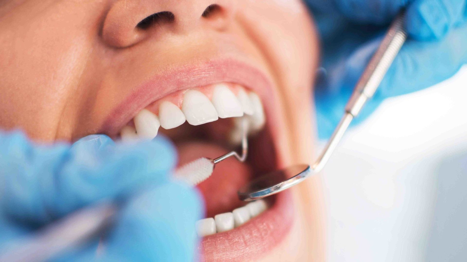 dental hygienist at work at our dental clinic in Currambine, City of Joondalup