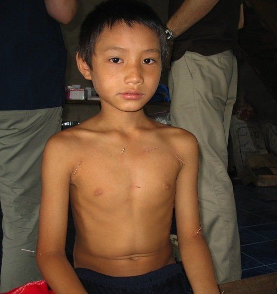 young boy being treated