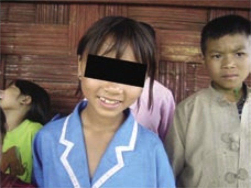A girl with a black block on her eyes smiles for the camera