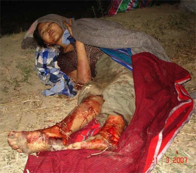 young man injured