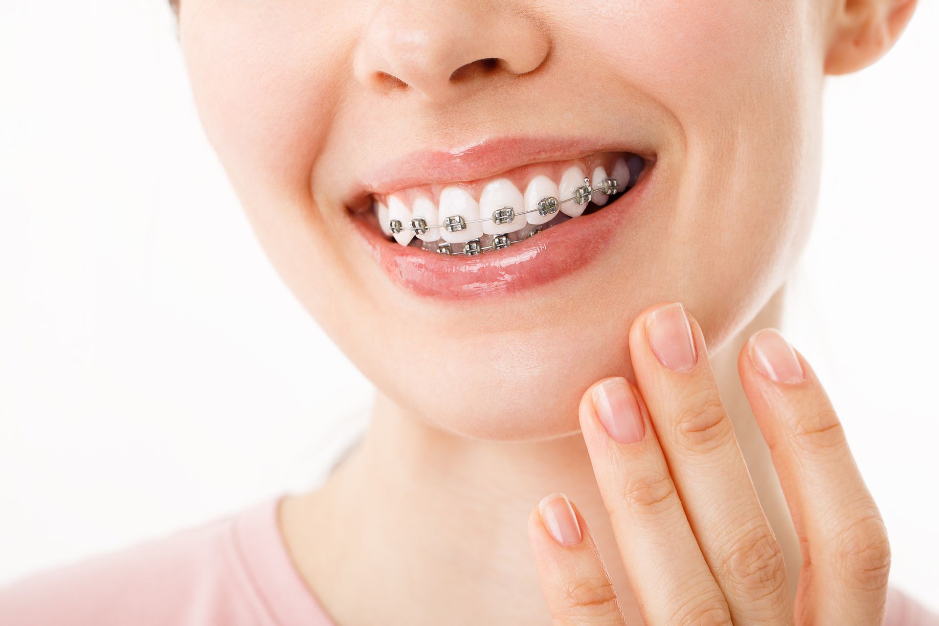 Lucent Orthodontics, San Antonio. A smiling person with visible metal dental braces on their teeth, with a hand resting near their chin.