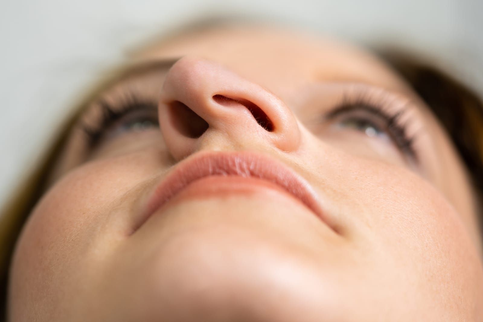A close up of a woman 's nose with a severe deviated septum.