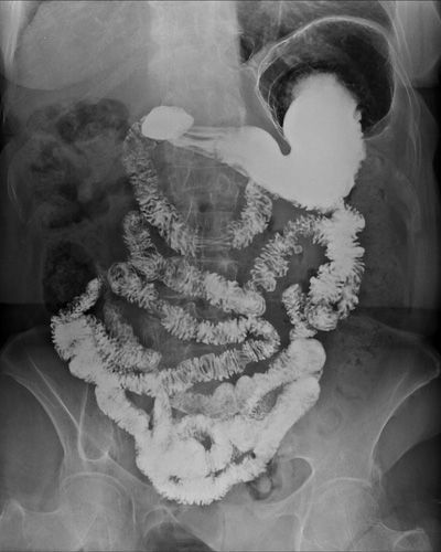 studio apparato digerente