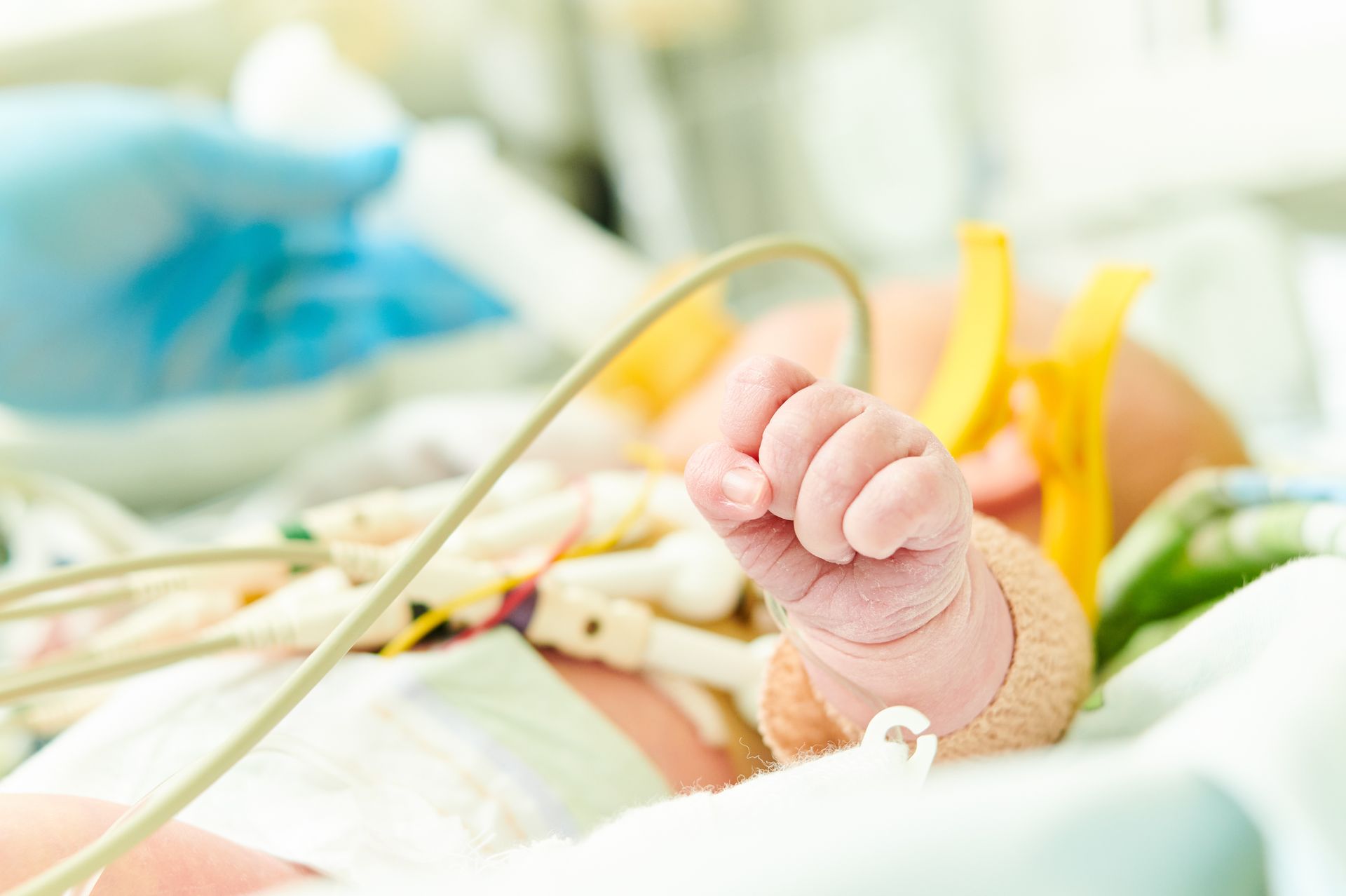 A close up of a baby 's hand in an incubator. Friends of Alfie Martin