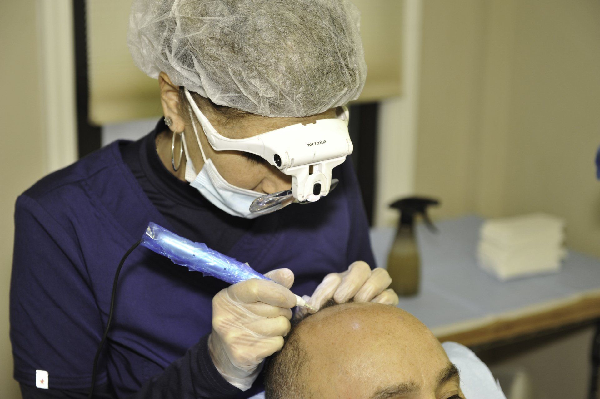 Man getting hair replacement service also known as scalp micropigmentation