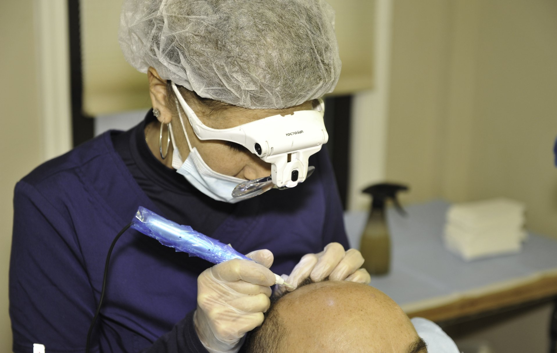 Hair Replacement Service also known as Scalp Micropigmentation