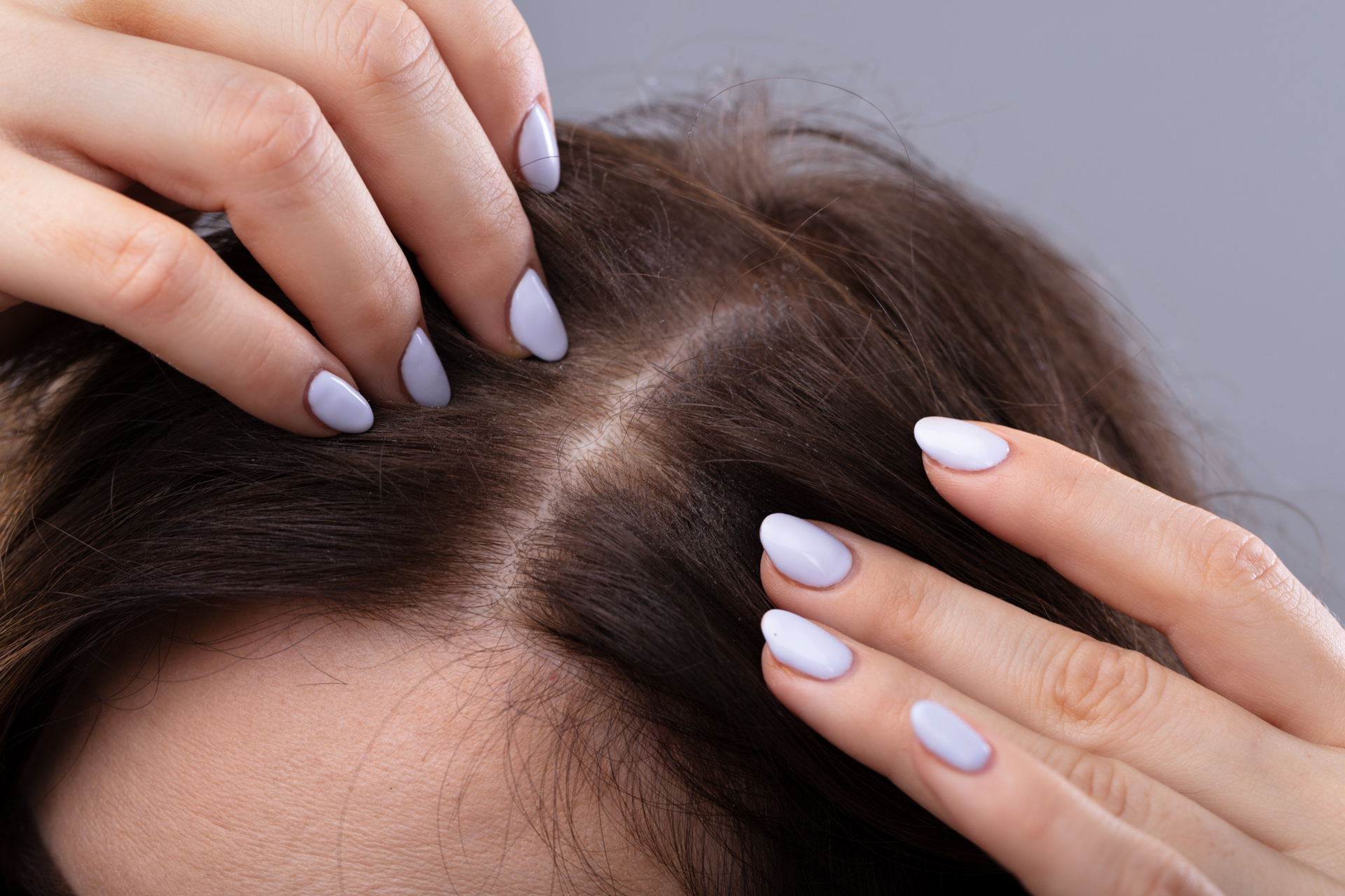 Scalp Micropigmentation Hair Density for Women