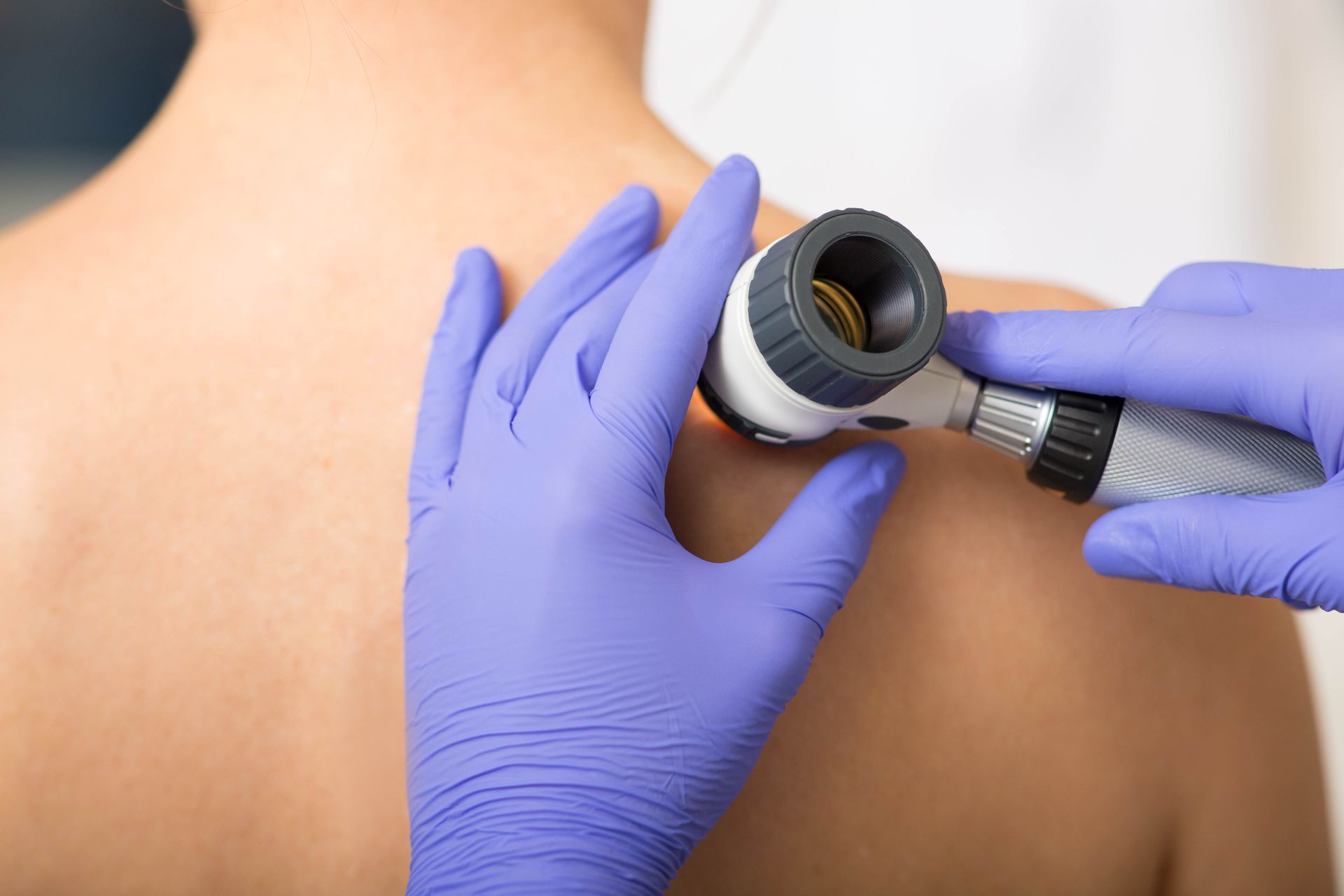 Dermatologist examining a patient’s skin during a professional medical consultation.