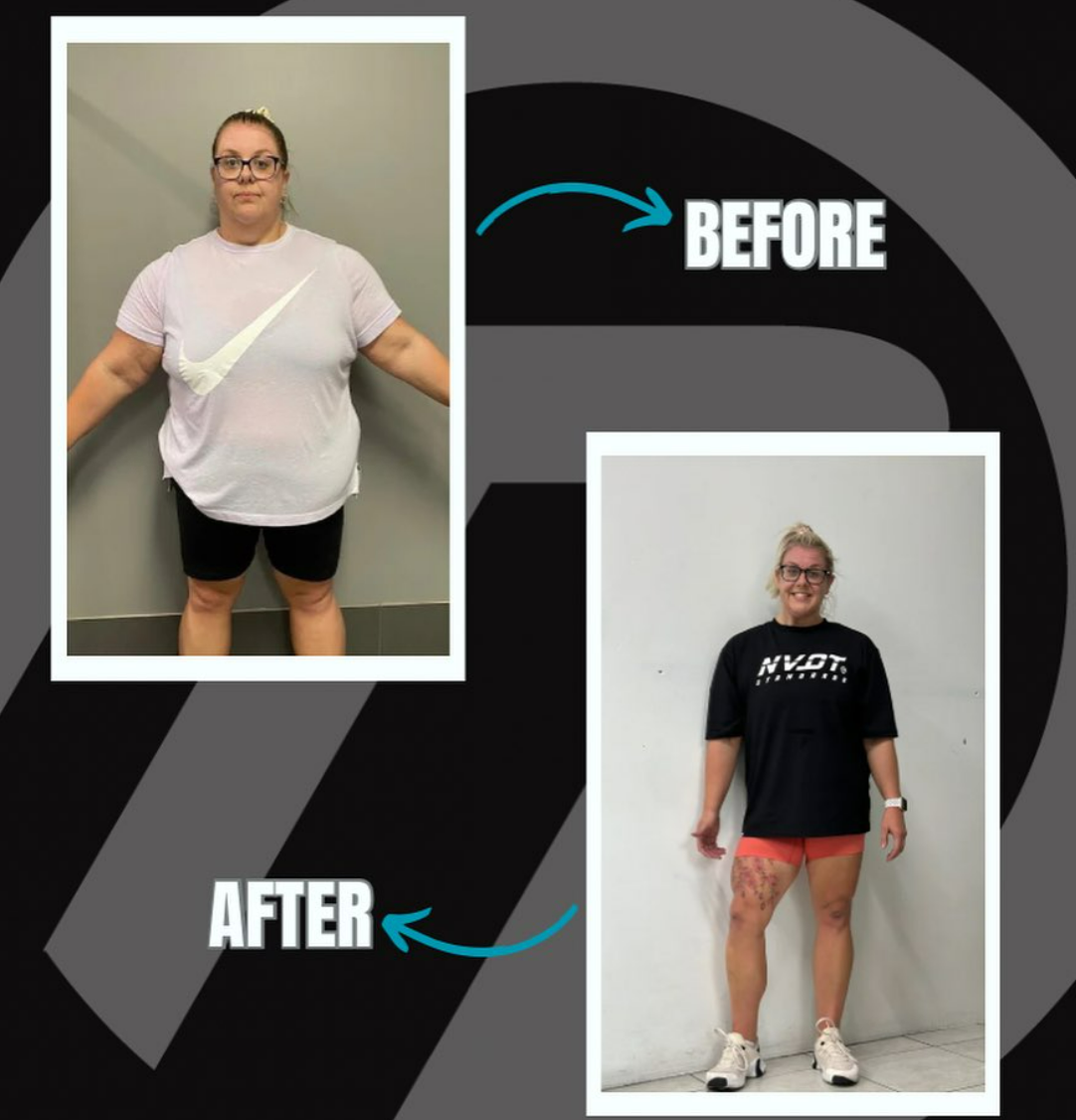 A picture of a woman before and after losing weight
