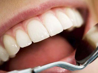 bocca aperta durante una visita dentistica