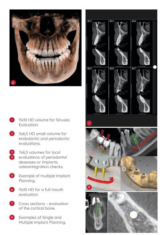 Choosing the Right CBCT for Your Dental Practice