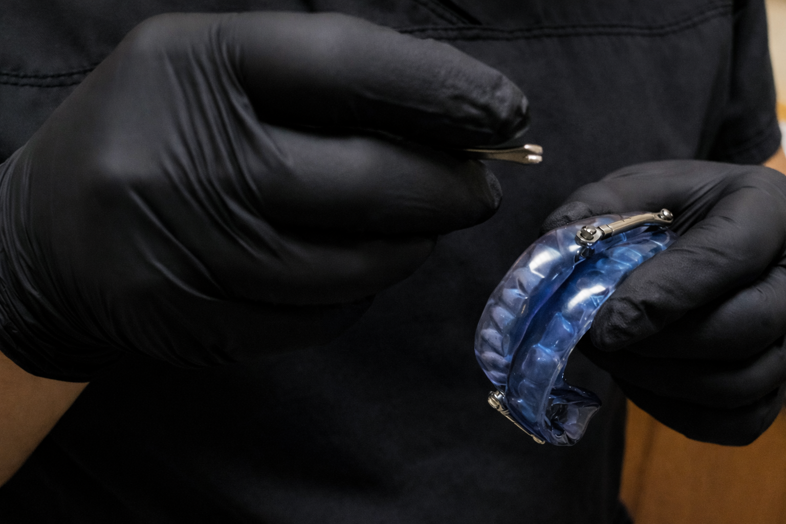 Person in black gloves holding a blue dental sleep apnea appliance and metal tool.